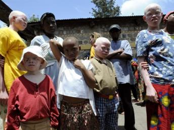 Des enfants de « la Maison des Albinos» à Ruyigi. AFP/STEPHANE DE SAKUTIN