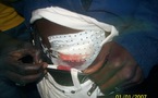 PHOTOS Attaque du siège du PDS à Guédiawaye : neuf blessés dont quatre graves, l’UJTL menace