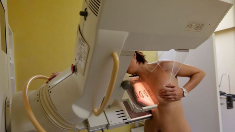 ​Docétaxel et cancer du sein: «La baisse de globules blancs a dégénéré»