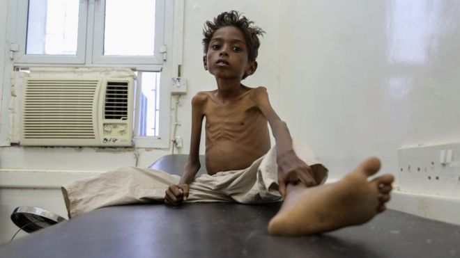Famine : quatre pays touchés