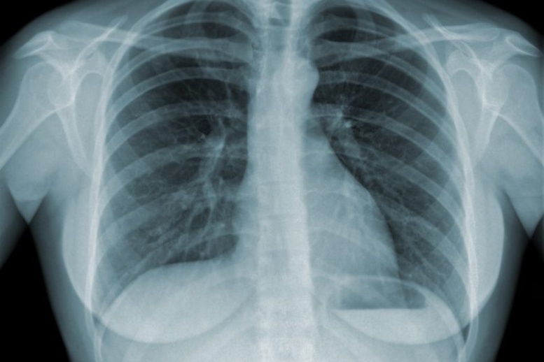 Journée mondiale de lutte contre la tuberculose: 13166 cas enregistrés en 2016 au Sénégal Journée mondiale de lutte contre la tuberculose: 13166 cas enregistrés en 2016 au Sénégal