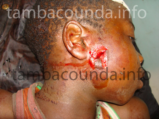 L'enfant de moins de 15 ans blessé par balle  (photo : www.tambacounda.info)