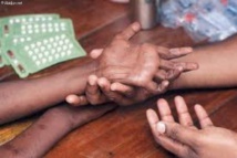 La lèpre refait surface à Mbour et Kaolack La lèpre refait surface à Mbour et Kaolack