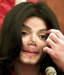 Résultat de l'autopsie: Michael Jackson est mort dans un état épouvantable
