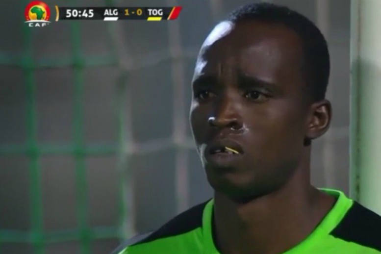 Du jamais vu : Le gardien du Togo avait un cure-dent dans la bouche pendant tout le match