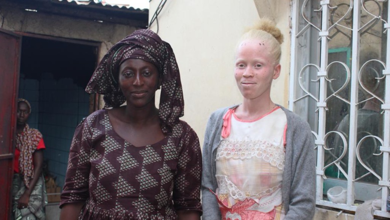 La mère, Nabiya, et une de ses filles, Ancha (16 ans), albinos. Elle a 3 filles albinos sur 7 enfants au total. © RFI/Claire Bergelès