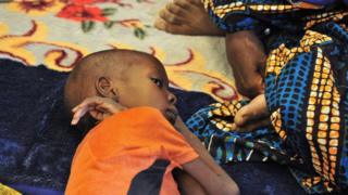 Mali : l'UNICEF tire la sonnette d'alarme sur la malnutrition
