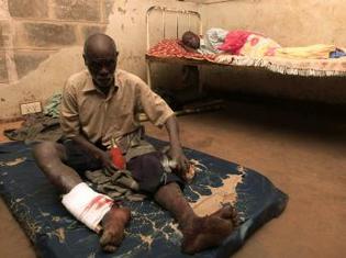Des victimes du glissement de terrain survenu dans la nuit du 1er au 2 mars 2010 sont soignées à l'hopital de Budaka. (photo: Reuters)