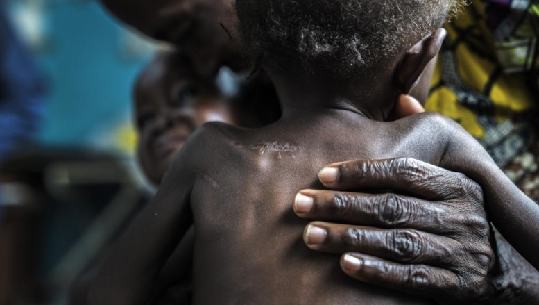 ​RDC: des ONG appellent à une aide d'urgence pour les populations du Kasaï