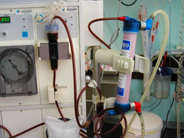 Maladie des reins aigus : plus de 600 cas enregistrés au Sénégal