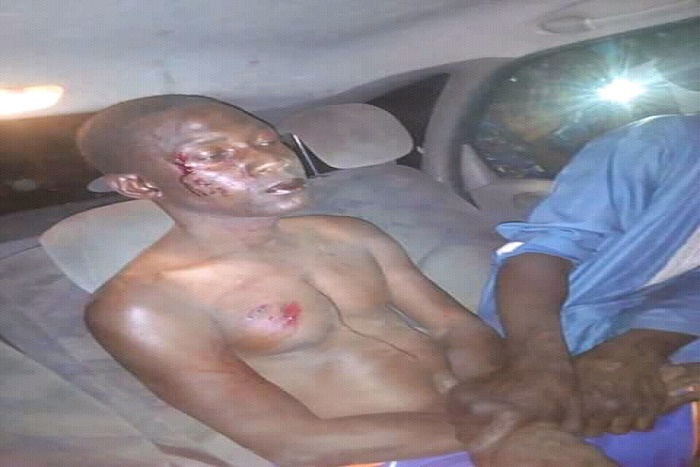 ​Touba : un homme échappe à la mort après un lynchage