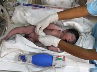 Baisse de la mortalité des enfants de moins de 5 ans dans le monde.