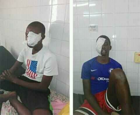 Eléves gravement blessés par les policiers à Thiès : Serigne Mbaye Thiam envoie un émissaire pour constater les dégâts