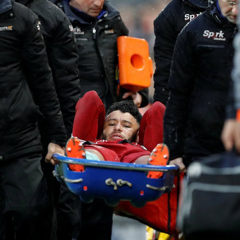 BREAKING !!! Alex Oxlade-Chamberlain forfait pour le Mondial BREAKING !!! Alex Oxlade-Chamberlain forfait pour le Mondial