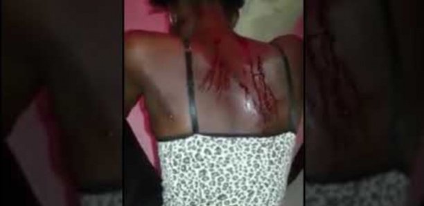 Femme battue à Touba : un mandat d'arrêt lancé contre son époux Bara Sow qui se serait enfui en...