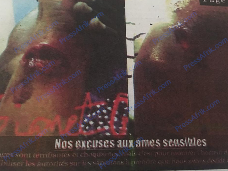 Charcutée par sa coépouse, la victime raconte l’horreur Charcutée par sa coépouse, la victime raconte l’horreur