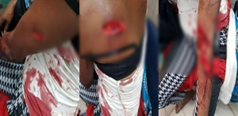 Salimata Diaw risque 5 ans de prison pour avoir charcuté sa co-épouse : sa version des faits... Salimata Diaw risque 5 ans de prison pour avoir charcuté sa co-épouse : sa version des faits...