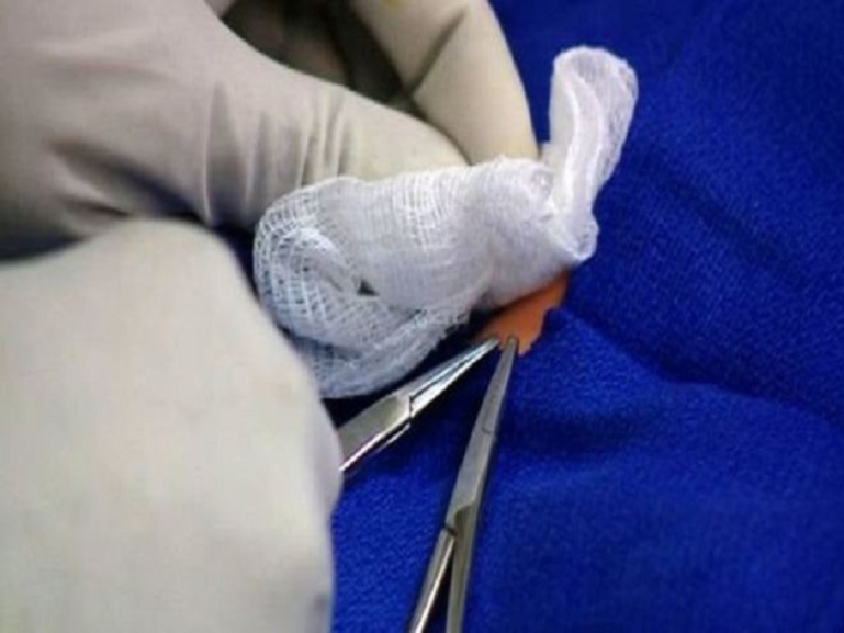 Un bébé nigérian de 2 ans meurt en Italie à la suite d'une circoncision Un bébé nigérian de 2 ans meurt en Italie à la suite d'une circoncision