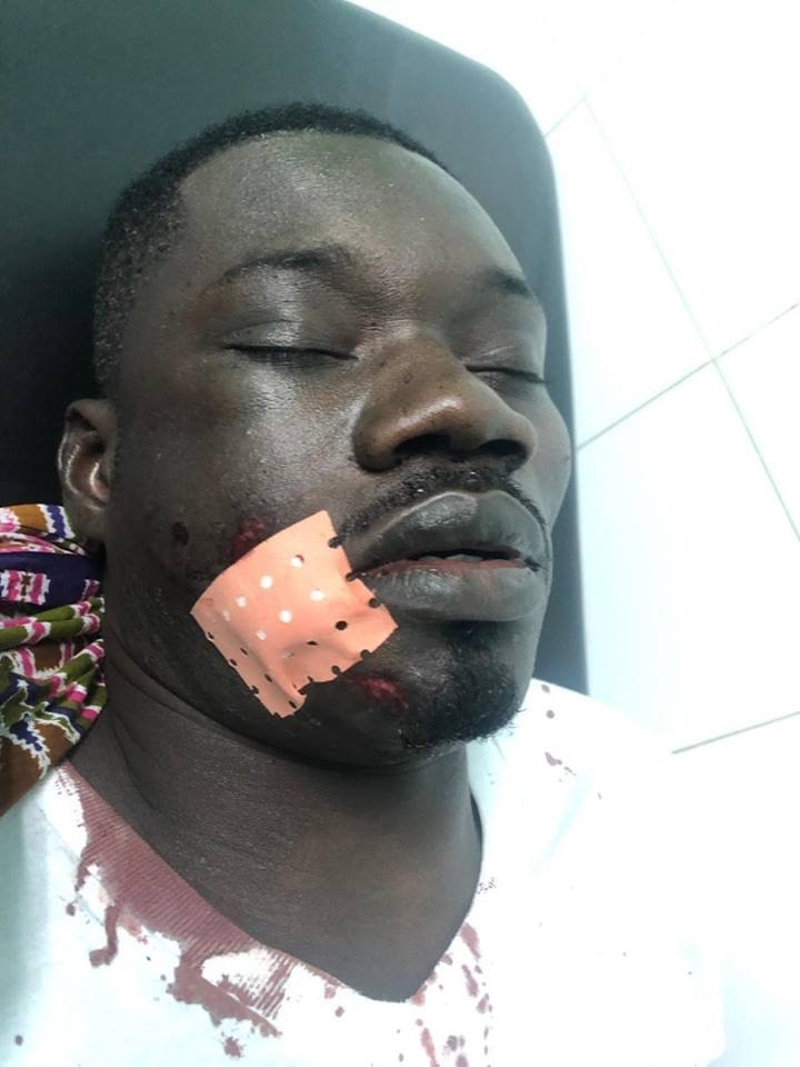 L’animateur Guin Thieuss sauvagement agressés (Photos) L’animateur Guin Thieuss sauvagement agressés (Photos)