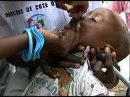 Ziguinchor-Campagne de supplémentation: 100 000 enfants seront vaccinés