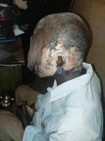 Pour régler ses comptes à son mari qui a convolé en secondes noces : Dandjo Sidibé ébouillante son époux, Karim Sidibé