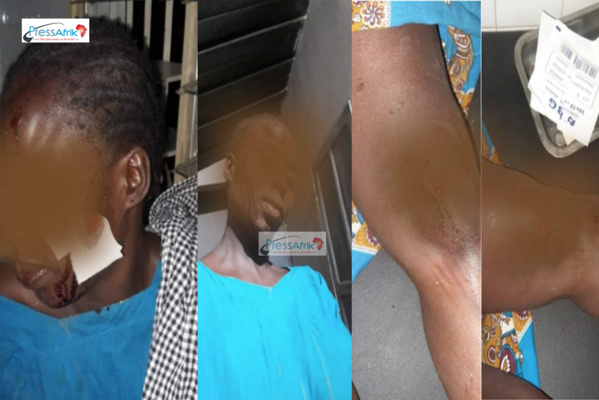 ​Département Mbour: le Chef de poste Vétérinaire de Nguéniène agressé par des voleurs (Photo)