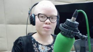 "Je me sens davantage en sécurité, en tant qu'albinos"