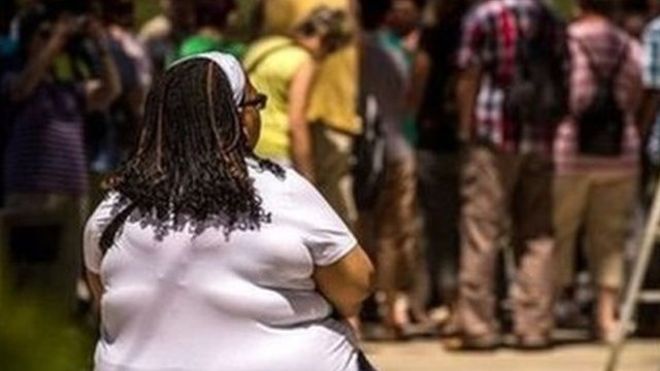 'L'obésité cause plus de cas de cancers que le tabagisme'