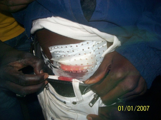 PHOTOS Attaque du siège du PDS à Guédiawaye : neuf blessés dont quatre graves, l’UJTL menace