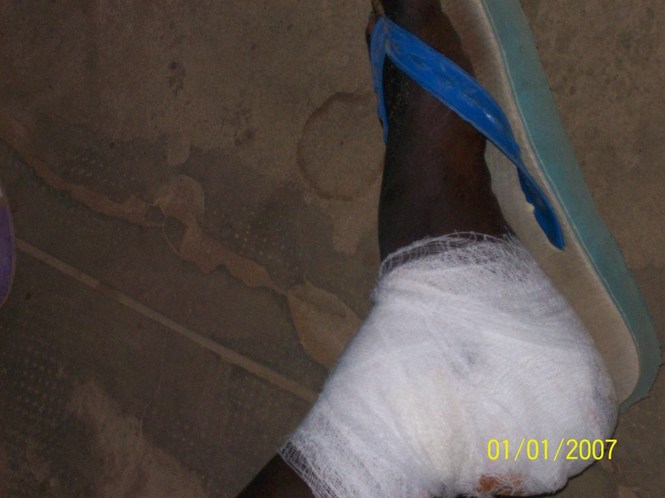 PHOTOS Attaque du siège du PDS à Guédiawaye : neuf blessés dont quatre graves, l’UJTL menace