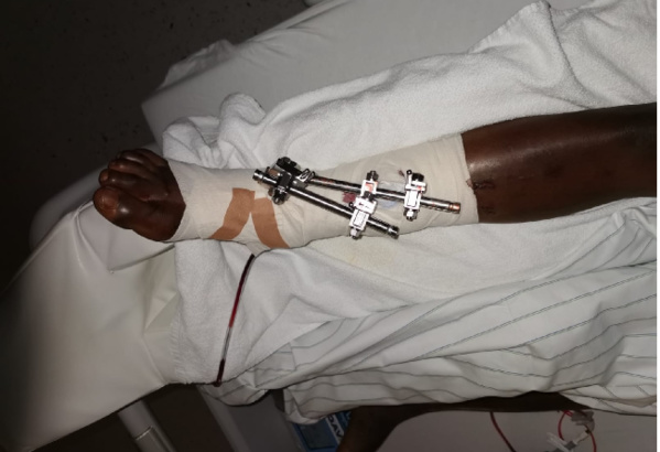 Allemagne: un Sénégalais saute de l'immeuble de la police après le rejet de sa demande d’asile Allemagne: un Sénégalais saute de l'immeuble de la police après le rejet de sa demande d’asile