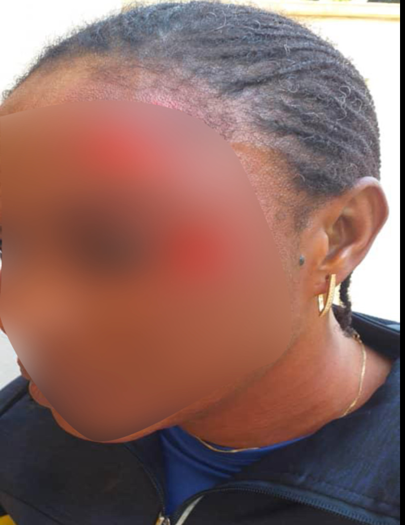 Lycée Blaise Diagne de Dakar: une élève agresse son professeur d’EPS et la défigure... les cours suspendus Lycée Blaise Diagne de Dakar: une élève agresse son professeur d’EPS et la défigure... les cours suspendus