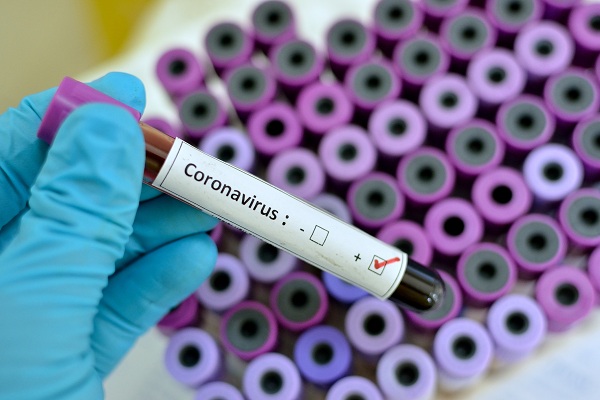#Coronavirus - Les dangereuses déclarations d'une commerçante sénégalaise à Paris sur le point de rentrer à Dakar