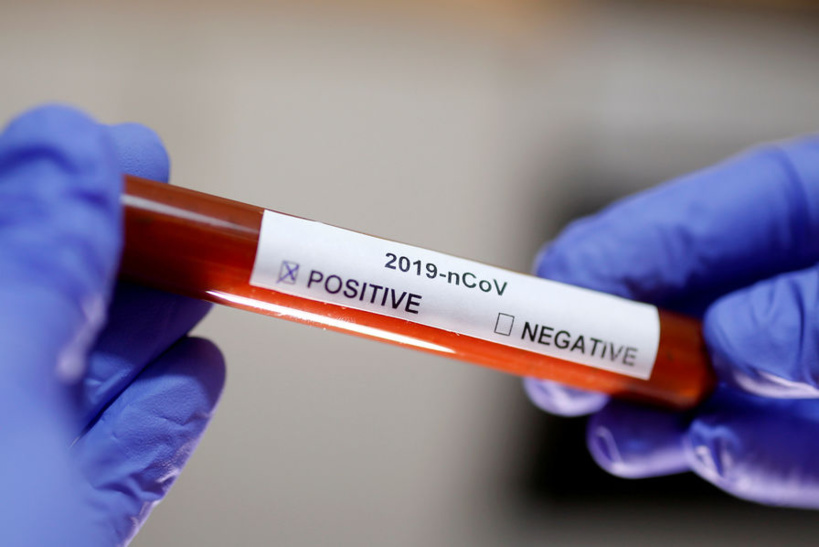Coronavirus: l'institut Pasteur reconnaît des dysfonctionnements dans l'analyse des tests