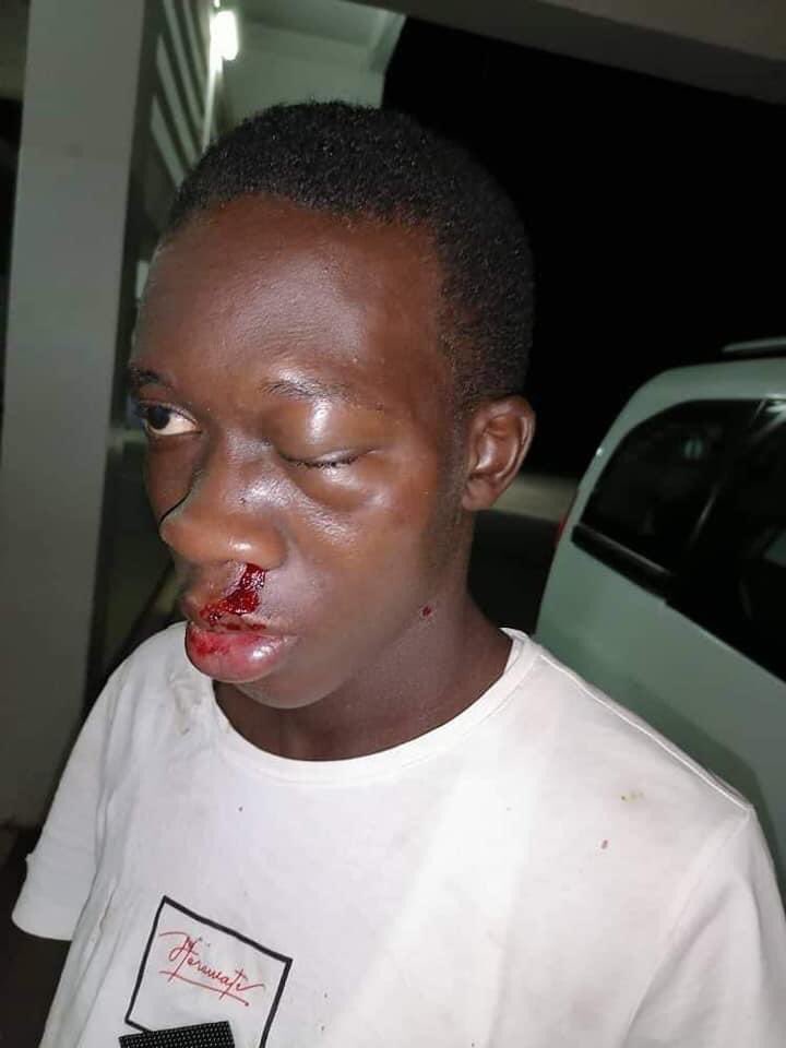 Un Agent de la Sécurité de Proximité fracasse le visage d’un jeune boulanger à Diourbel... pour non-respect du couvre-feu