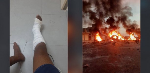 Samedi soir très tendu à l'UGB Saint-Louis: un bus incendié, quatre étudiants blessés