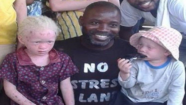 No stress Land vole au secours des albinos du village de Niayekhayes