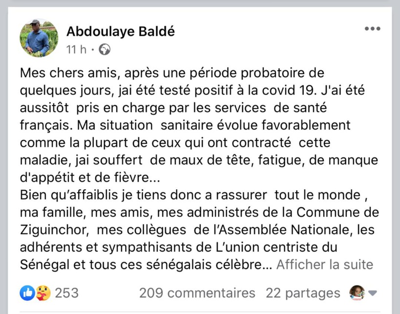 Abdoulaye Baldé testé positif à la Covid-19