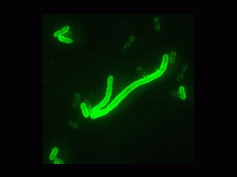 Vue du bacille Yersinia Pestis avec un grossissement de 200 en fluorescence. Porté par les puces, le bacille est responsable des différentes manifestations de la peste. © CDC/Larry Stauffer/Wikipédia