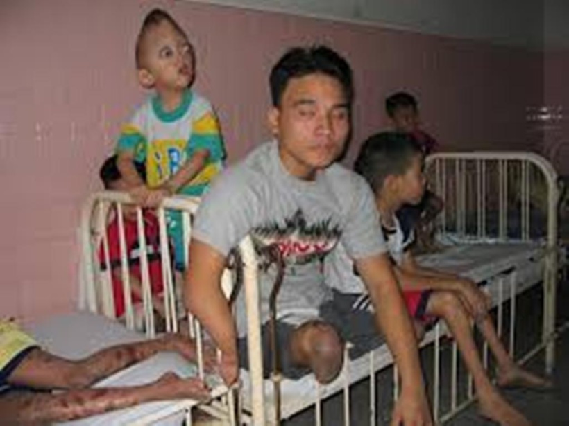 France : le procès historique de l’Agent Orange France : le procès historique de l’Agent Orange