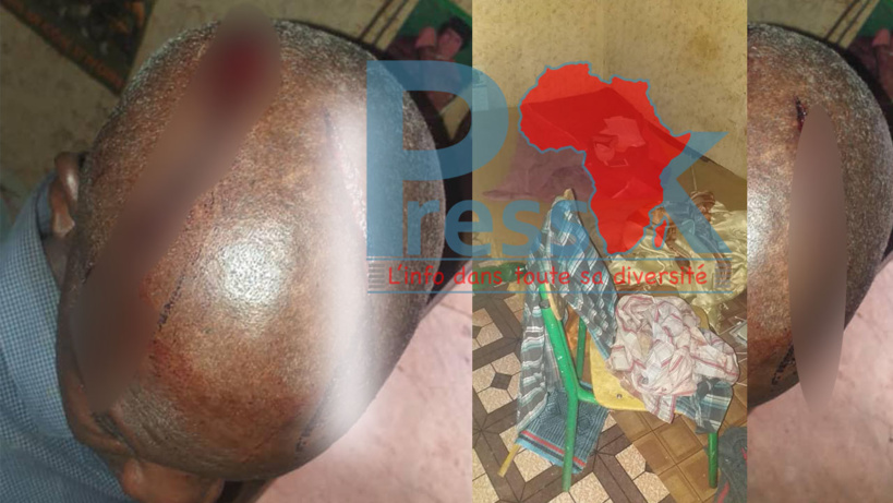 Ecoles Kelle et Bedeu Dieng: les enseignants désertent les cours après les agressions de leurs collègues Ecoles Kelle et Bedeu Dieng: les enseignants désertent les cours après les agressions de leurs collègues