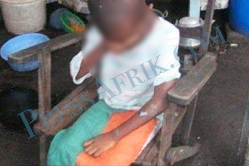 Accidents domestiques chez les enfants: un cas reçu chaque semaine à Albert Royer Accidents domestiques chez les enfants: un cas reçu chaque semaine à Albert Royer