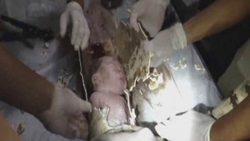 Chine: un nouveau né sauvé de la tuyauterie