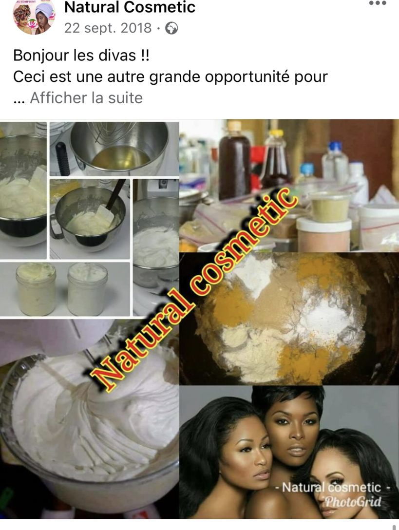 Business des crèmes éclaircissantes: les utilisateurs à la merci des « chimistes cosmétiques » exposent leurs peaux à maints dangers Business des crèmes éclaircissantes: les utilisateurs à la merci des « chimistes cosmétiques » exposent leurs peaux à maints dangers