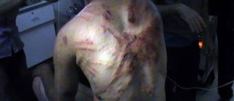 Diourbel-Accusation de torture : le détenu Issa Diaw « malmené » par deux matons