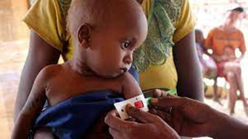 Madagascar: le directeur du PAM dans le Sud en raison de la famine Madagascar: le directeur du PAM dans le Sud en raison de la famine