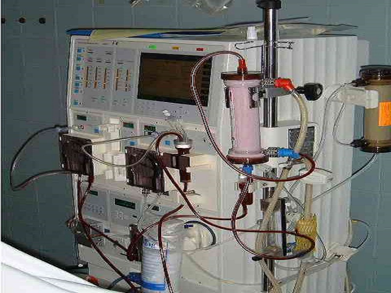 Covid-19 : 417 séances d’hémodialyses réalisées dont 21 décès enregistrés (spécialiste)