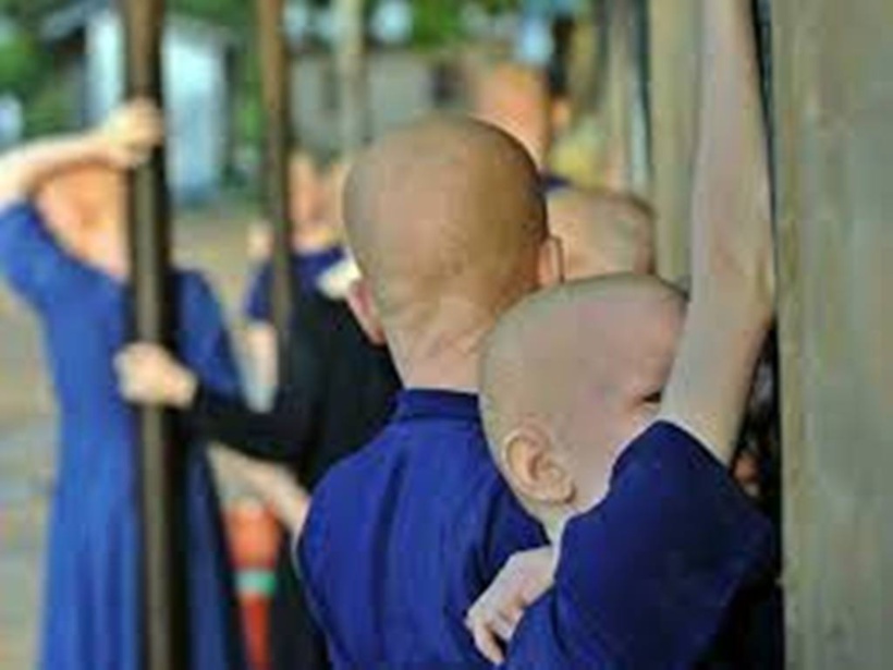 Madagascar: les enlèvements d'albinos, en particulier des enfants, se multiplient Madagascar: les enlèvements d'albinos, en particulier des enfants, se multiplient