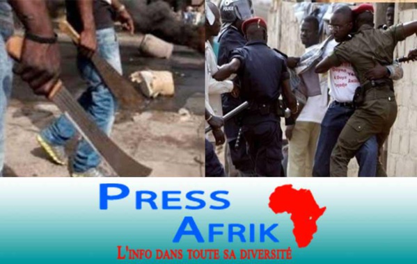 L’insécurité galope à Grand-Yoff: Diouldé Baldé reçoit des coups de sabre à la main et à la tête L’insécurité galope à Grand-Yoff: Diouldé Baldé reçoit des coups de sabre à la main et à la tête