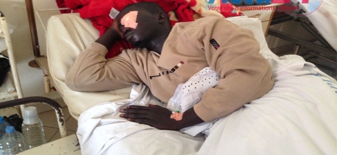 UCAD: les étudiants donnent 48 heures à l'Etat pour évacuer leur camarade "rendu borgne" au cours d'un front